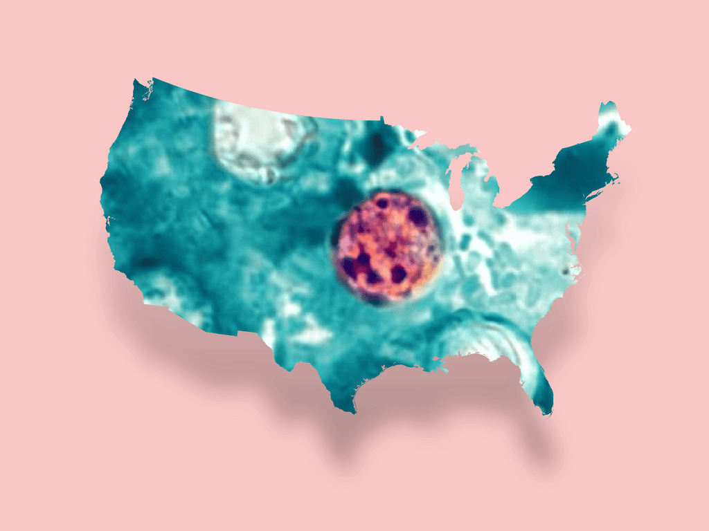 icon for Cyclosporiasis cases in U.S. by July 31?